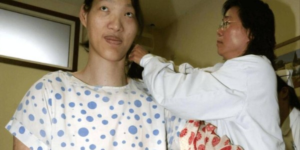 九游体育官网-世界第一女巨人来自中国安徽，穿78码的鞋子，一顿饭吃六碗炒面